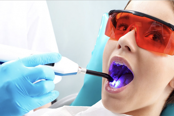 CURA DENTI SENZA TRAPANO